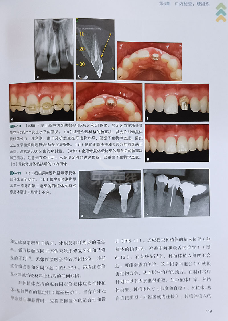 牙齒修復前沿技術(shù)觀(guān)點(diǎn)論述