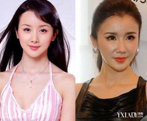 探秘明星整容的秘密，神秘美容小店的魅力所在！